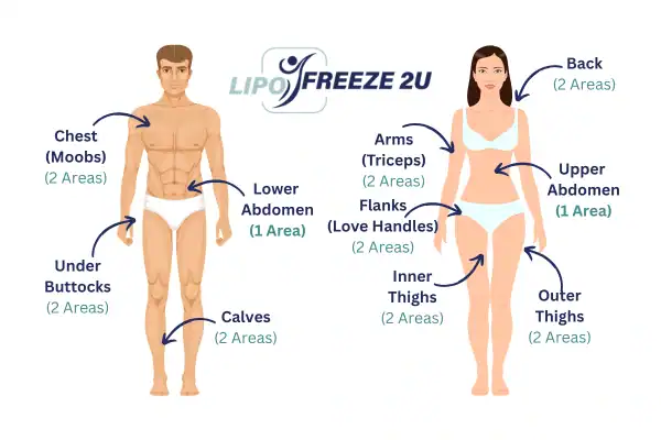 Areas you can have fat freezing treatment Slough