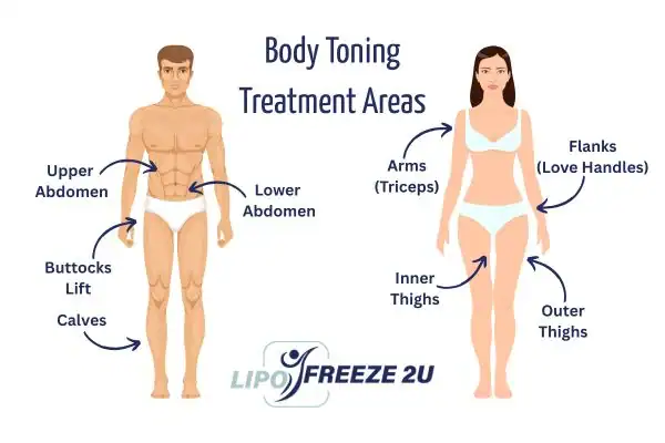 Graphic showing where you can have Body toning Treatment Slough on your body
