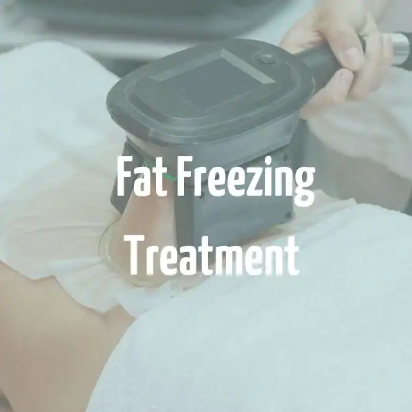 fat freezing treatment Slough