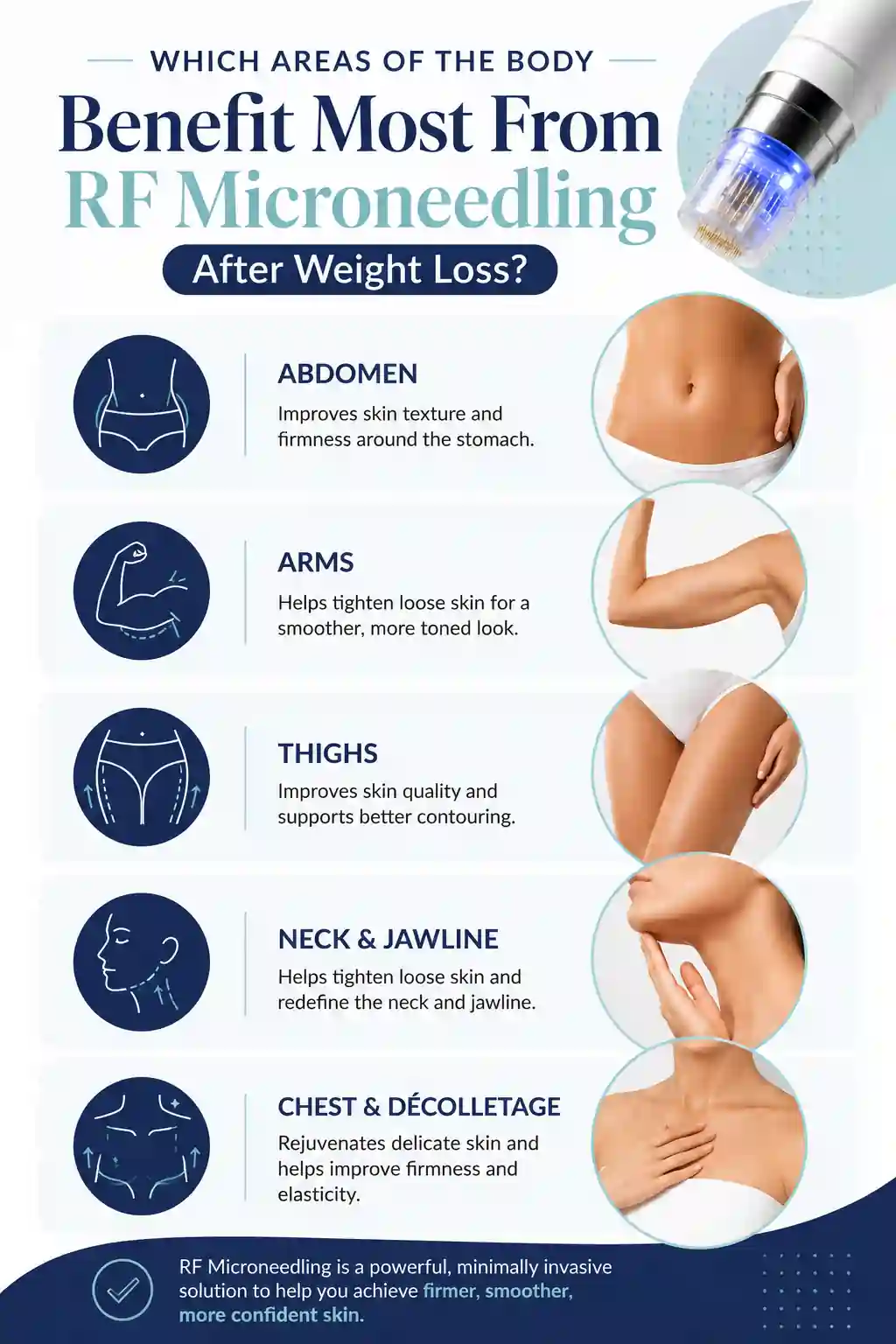 Which Areas of the Body Benefit Most From RF Microneedling After Weight Loss Slough